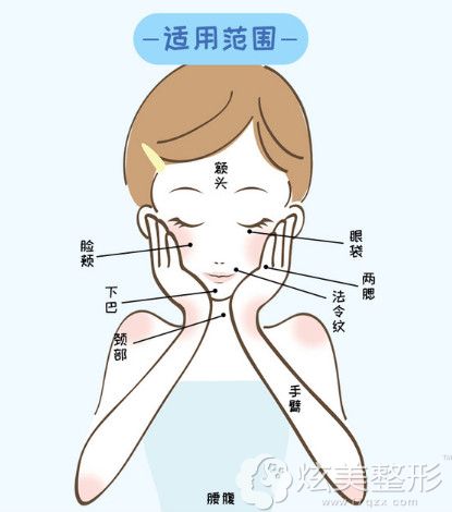 热玛吉、深蓝射频和热拉提除皱范围不同 热玛吉、深蓝射频和热拉提除皱范围不同
