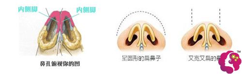 鼻头大的表现 鼻头大的表现