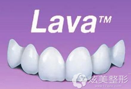 美国Lava拉瓦全瓷牙 美国Lava拉瓦全瓷牙