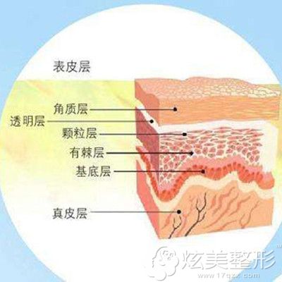 微针祛痘印作用到的皮肤层次 微针祛痘印作用到的皮肤层次