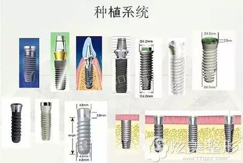种植系统的品牌不同价格不同 种植系统的品牌不同价格不同