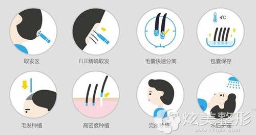 李少雄医生做毛发移植术过程 李少雄医生做毛发移植术过程