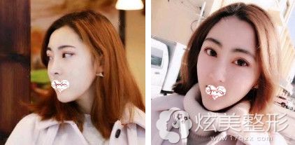 �轺¡�����󣳸��±��ӻָ���Ȼ