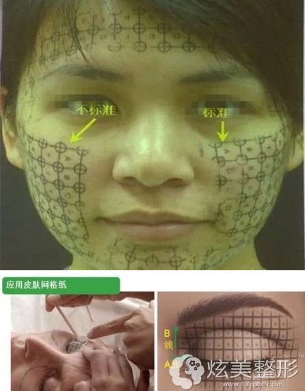 �������沿���۲����꼪���λ