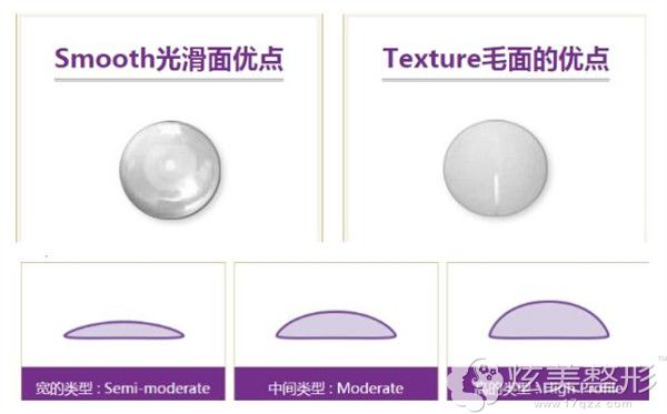 赛彬(SEBBIN)假体的类型 赛彬(SEBBIN)假体的类型