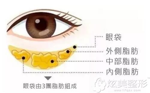 眼袋的形成原因 眼袋的形成原因