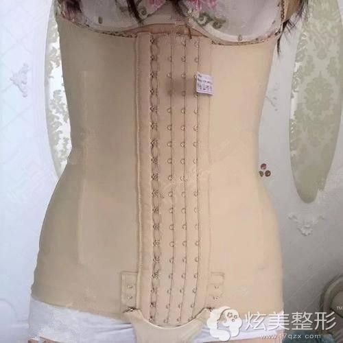 腰腹吸脂术后穿束身衣 腰腹吸脂术后穿束身衣