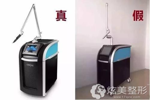 做激光祛斑要分清真假医疗设备 做激光祛斑要分清真假医疗设备