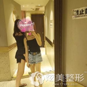做完大腿和腰腹吸脂后2个月恢复自然 做完大腿和腰腹吸脂后2个月恢复自然