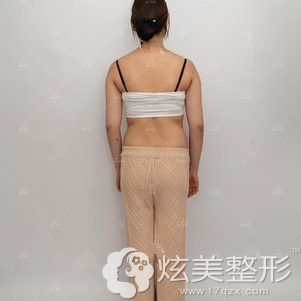 术前腰腹和大腿粗壮 术前腰腹和大腿粗壮