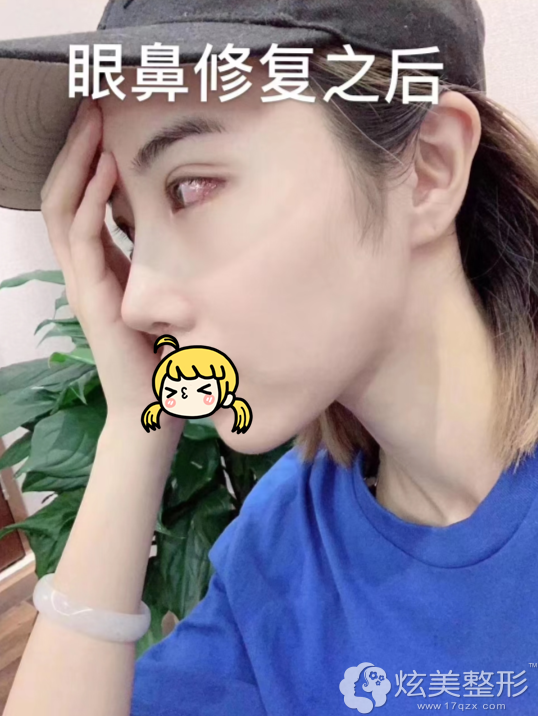 �ڳɶ�Ŧ������¡��ʧ�ܺ�˫��Ƥʧ���޸���