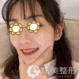 �������ݽ�������145��ָ�Ч��