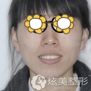 �����ݽ���ǰ�˿���������