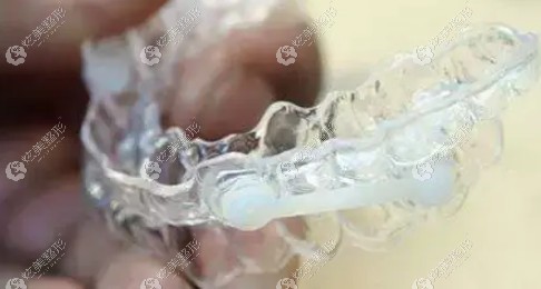 无托槽隐形矫正牙套 无托槽隐形矫正牙套