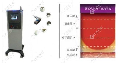 地四代热玛吉除皱 地四代热玛吉除皱