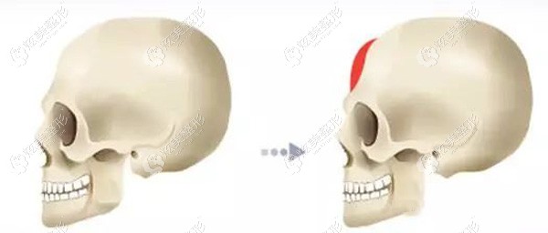 ������ͷ������ԭ��