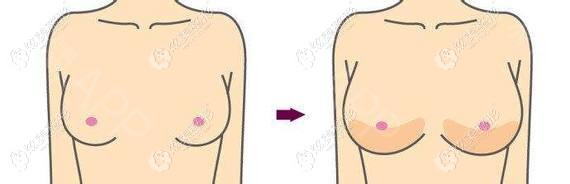 ����֬������ز�Ч���Ա�