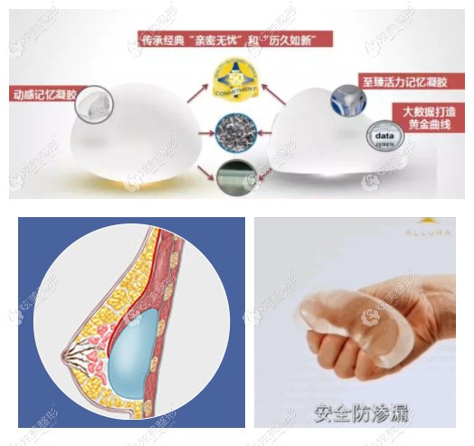 傲诺拉星熠微柔面假体优势 傲诺拉星熠微柔面假体优势