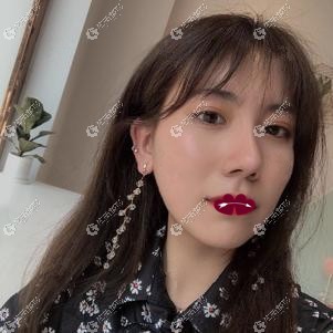 雨沙假体隆鼻术后恢复自然高挺 雨沙假体隆鼻术后恢复自然高挺