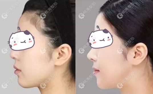 ��ʿ����¡�°�Ч���Ա�