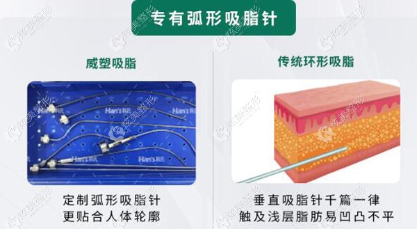 济南韩氏吸脂用的针也和普通的不同 济南韩氏吸脂用的针也和普通的不同