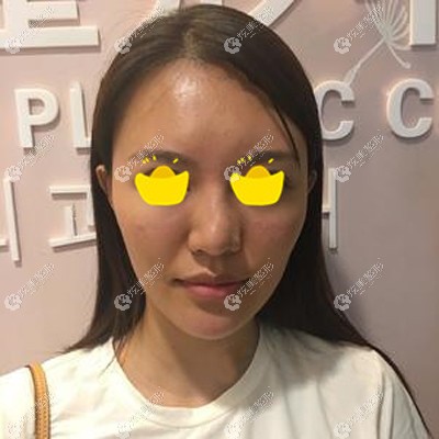 �ൺŵ����svf֬����+��ͨ֬�����ȫ��ʵ�ķ���