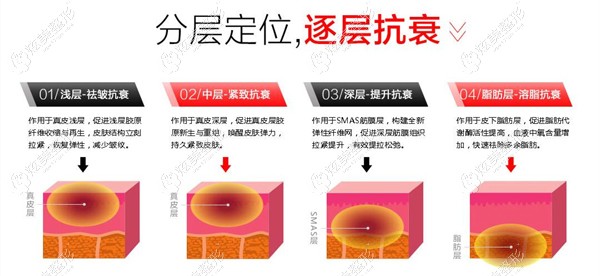 张院长做热拉提的原理 张院长做热拉提的原理