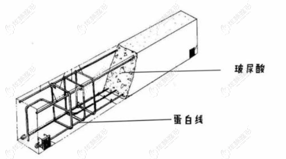 埋线提升+注射玻尿酸就好比支架与水泥 埋线提升+注射玻尿酸就好比支架与水泥
