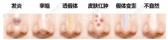 ��ʧ���޸�Ч��ͼ�������ں���ǽ�������