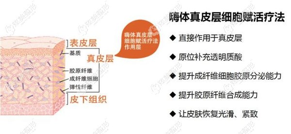 宋辉医生注射嗨体去颈纹 宋辉医生注射嗨体去颈纹