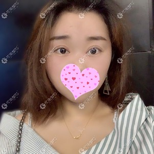 在天津欧菲做眼综合术后恢复自然 在天津欧菲做眼综合术后恢复自然