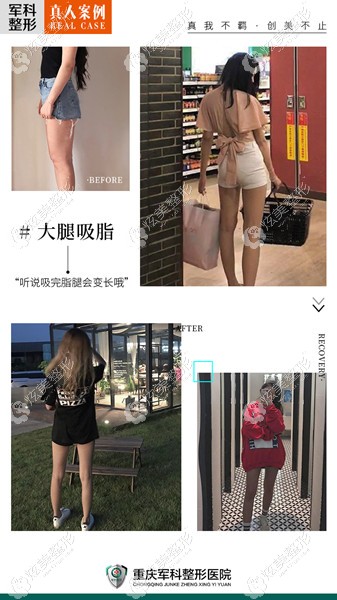 �������ײ��������������֬�ݴ���Ч��ͼ������������Χ������5cm������
