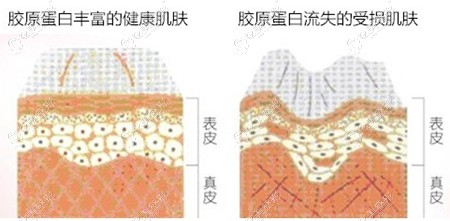 眼部音波提拉对眼袋有一定的效果 眼部音波提拉对眼袋有一定的效果