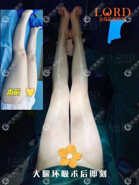 �������ൺ������ҽ�������Ȼ���2000ml֬�����ǰ��Ա���ʵͼƬ