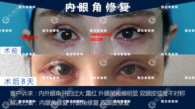 ���۽ǿ��Ĺ���¶�졢���۽ǰ̺������޸��Ա���
