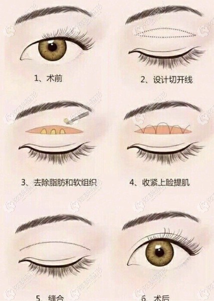 虞冬梅介绍,虞冬梅专家,虞冬梅做什么手术好,虞冬梅手术案例 - 炫美网