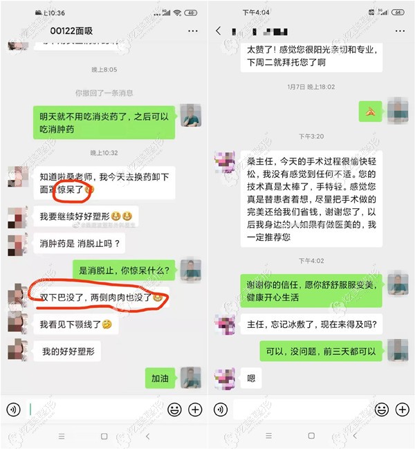 找桑建波医生抽脂的口碑好评 找桑建波医生抽脂的口碑好评