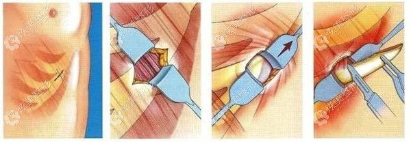 ���ٶ�ҽ�������޸���ȡ�߹��п�
