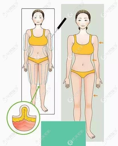 �ൺŵ����֬�ݴ��ȵ�ʵ������������λҽ������֬������