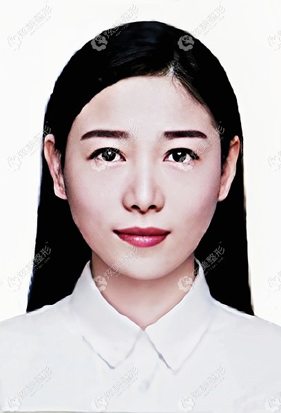 天津伊颂整形张羽晶医生 天津伊颂整形张羽晶医生