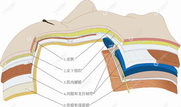 PSV面部提升采用采用五层闭合缝合法 PSV面部提升采用采用五层闭合缝合法