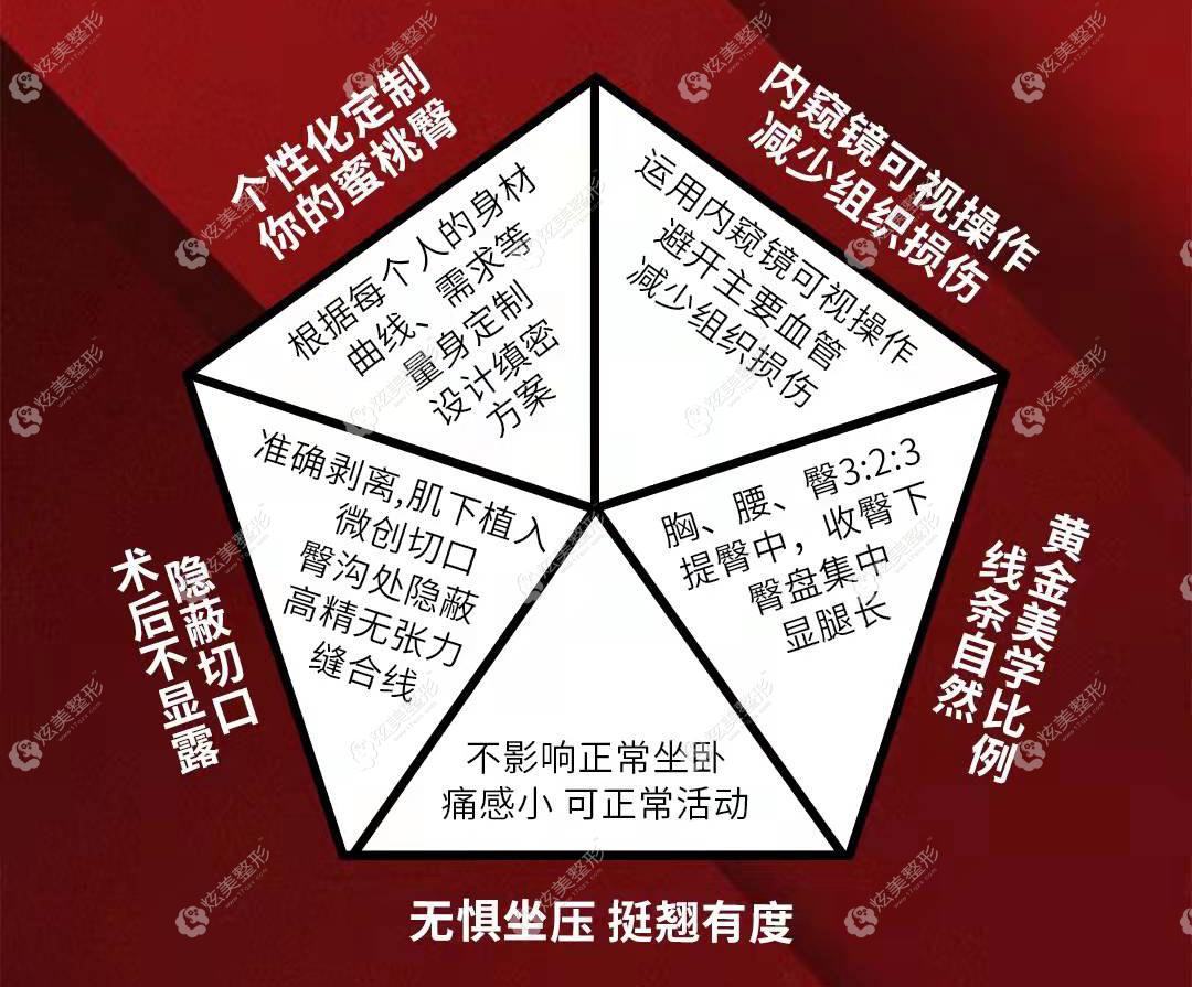 北京华韩医美做假体丰臀的技术优势 北京华韩医美做假体丰臀的技术优势