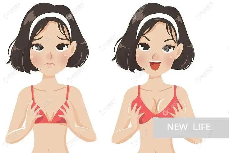 找鹏爱李罡做蓓拉假体深v乳沟隆胸前后对比照