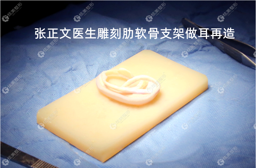 全国耳再造名医有哪些了解这份国内小耳再造医生排名榜就能知道