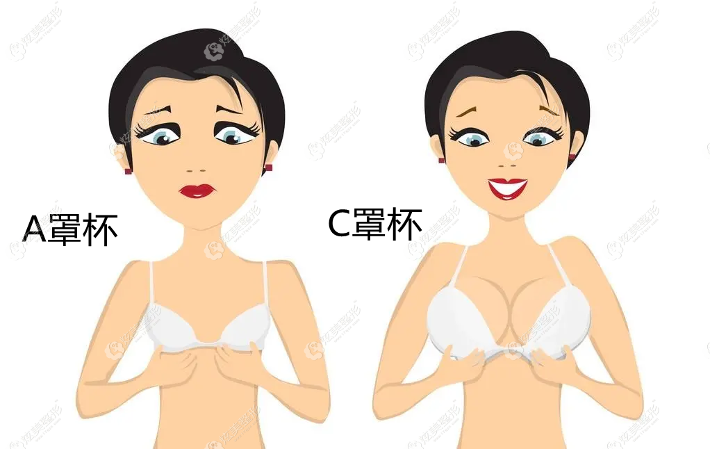 傲诺拉星熠240270295350cc中凸假体有多大对比图来看胸部大小