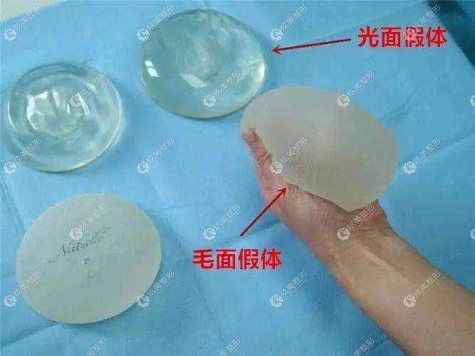 曼托光面和毛面假体的对比 曼托光面和毛面假体的对比