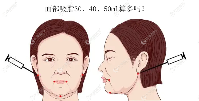 �沿��֬30��40��50ml����?Ϊɶ����ȫ����֬60mlǰ��Ա�û�仯