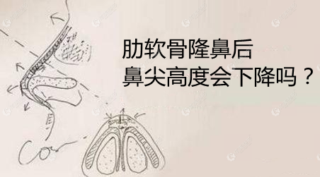 ������¡�Ǻ�Ǽ�߶Ȼ��½����ǲ���һ���һ�갫