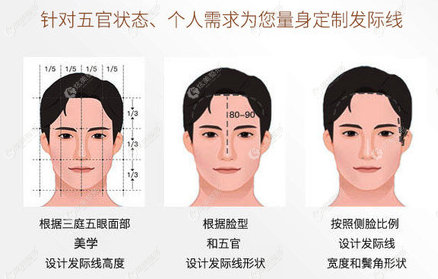 王灿领做植发手术优势 王灿领做植发手术优势