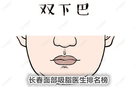 长春面部吸脂医生排名榜：陈继革、刘立民做脸部抽脂减肥的技术不错